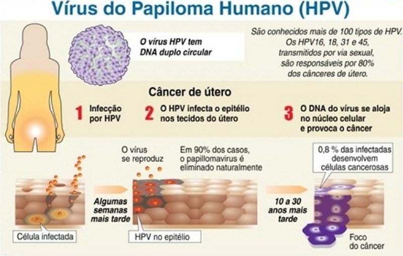 hpv02
