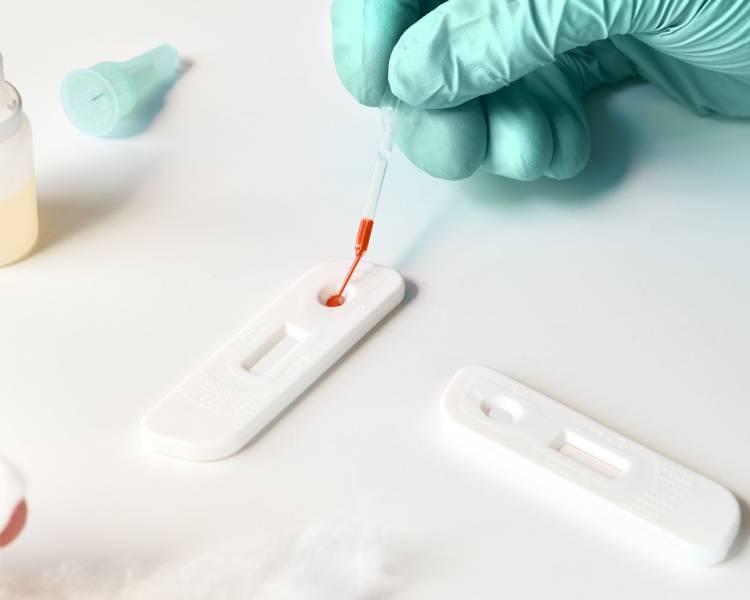 Julho Amarelo: campanha realiza mais de 2 mil testes rápidos e reforça a importância do diagnóstico precoce em Água Boa