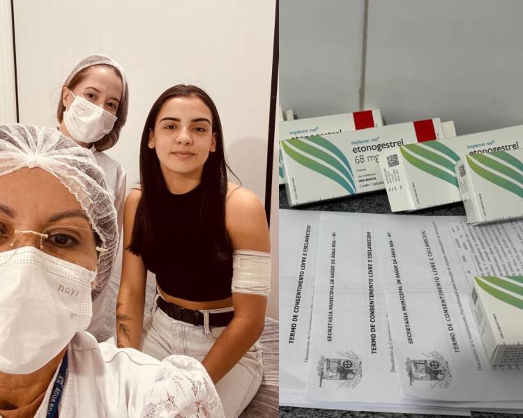 ESF Central realiza inserção de Implanon e reforça cuidado integral à saúde da mulher
